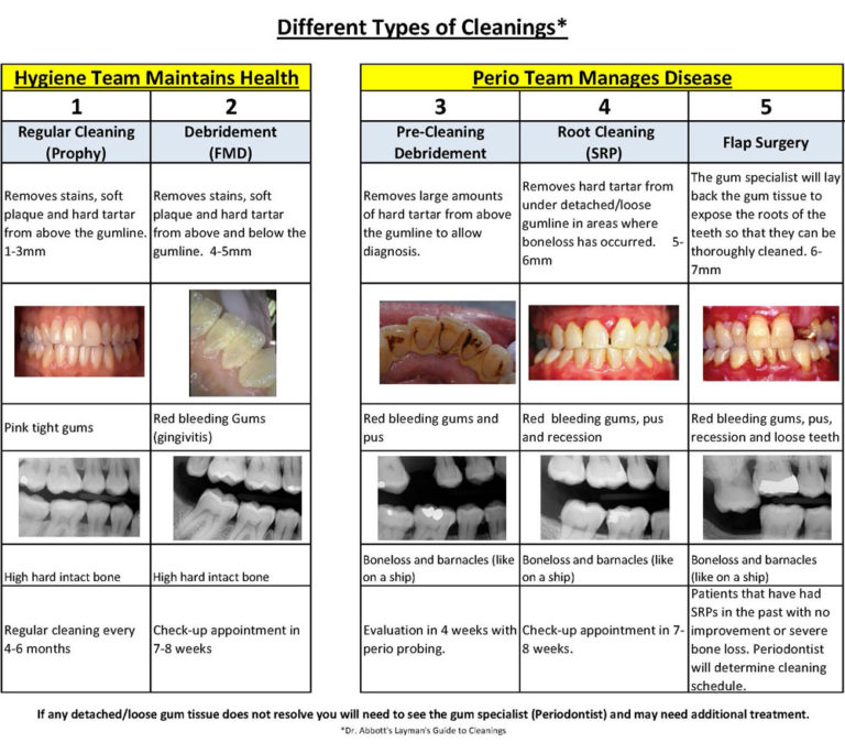 Types Of Dental Cleaning