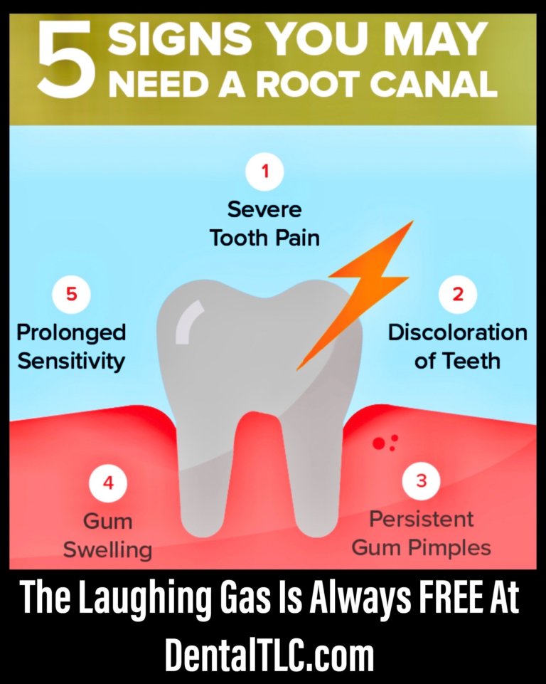 5 Signs You May Need A Root Canal | Dental TLC